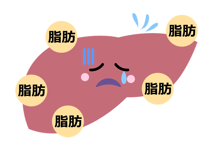脂肪肝とは